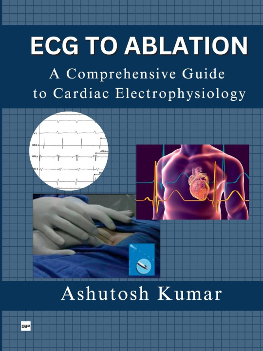 Buch ECG TO ABLATION Dr. Ashutosh Kumar