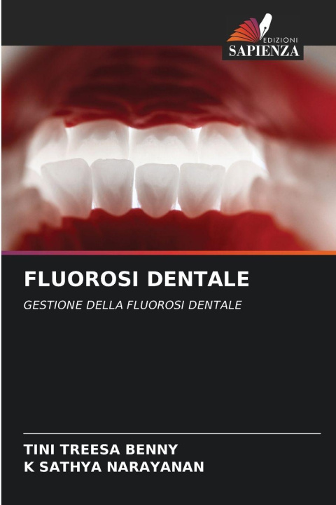 Knjiga FLUOROSI DENTALE K Sathya Narayanan