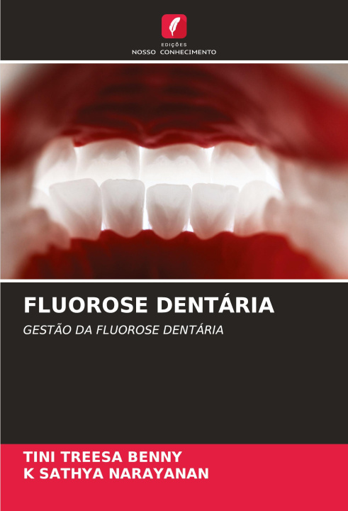 Kniha FLUOROSE DENTÁRIA K Sathya Narayanan