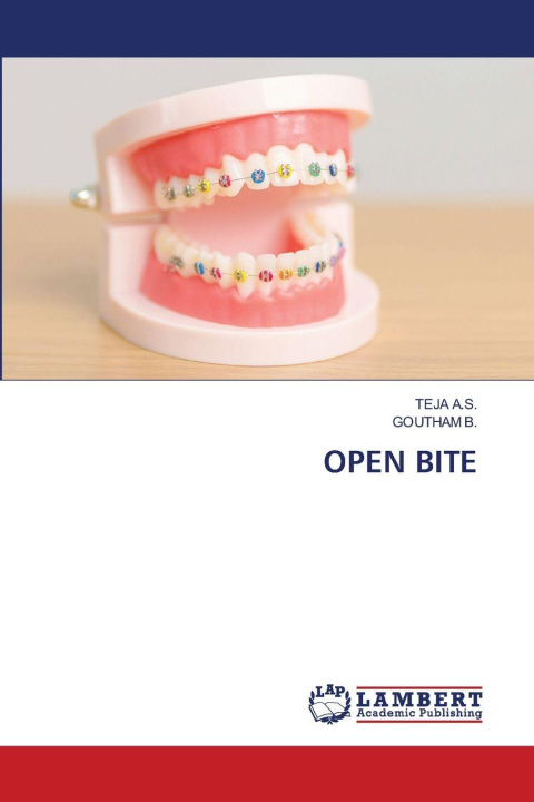 Kniha OPEN BITE Goutham B.