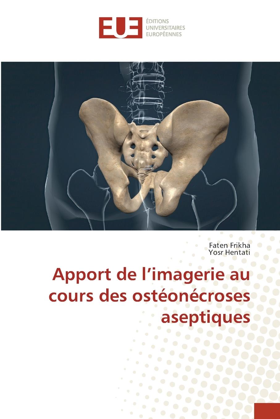 Kniha Apport de l'imagerie au cours des ostéonécroses aseptiques Yosr Hentati