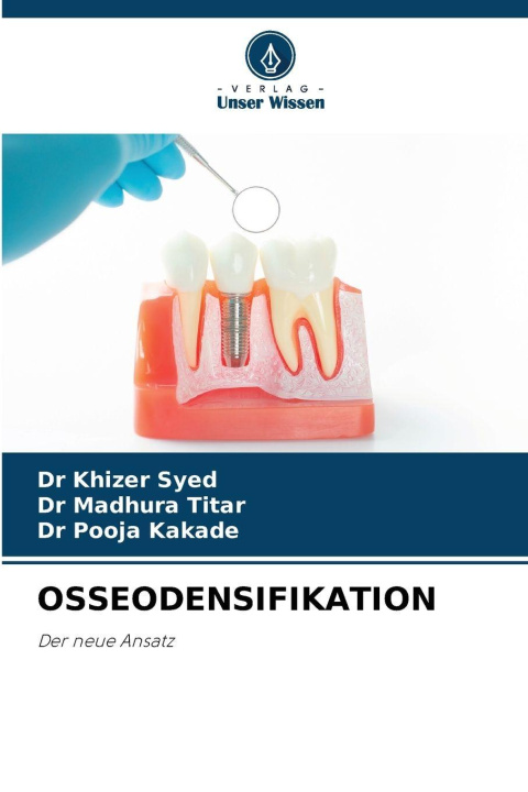Kniha OSSEODENSIFIKATION Dr Khizer Syed