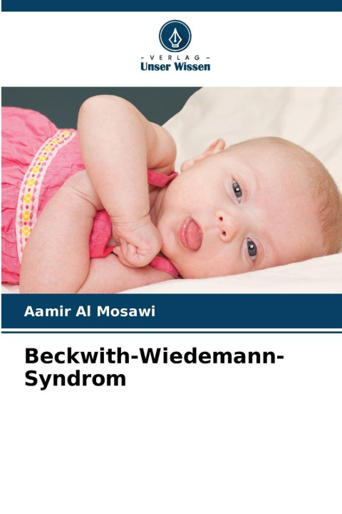 Knjiga Beckwith-Wiedemann-Syndrom Aamir Al Mosawi