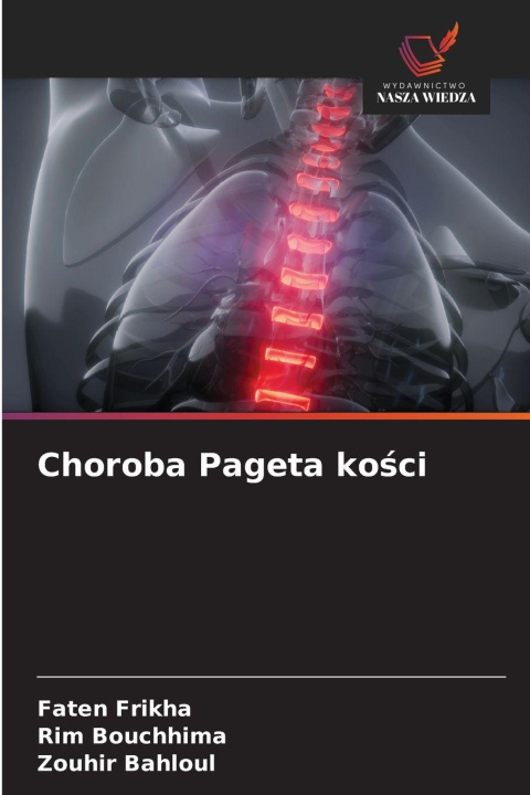 Knjiga Choroba Pageta ko¿ci Rim Bouchhima