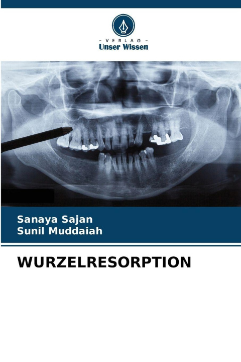 Kniha WURZELRESORPTION Sunil Muddaiah