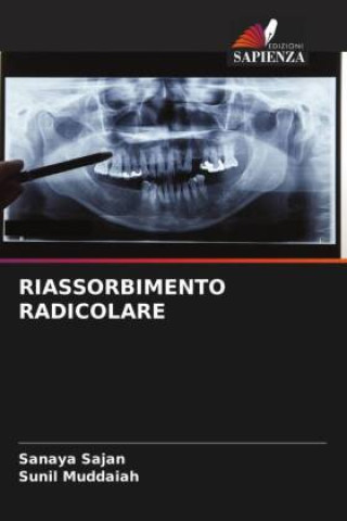 Buch RIASSORBIMENTO RADICOLARE Sunil Muddaiah