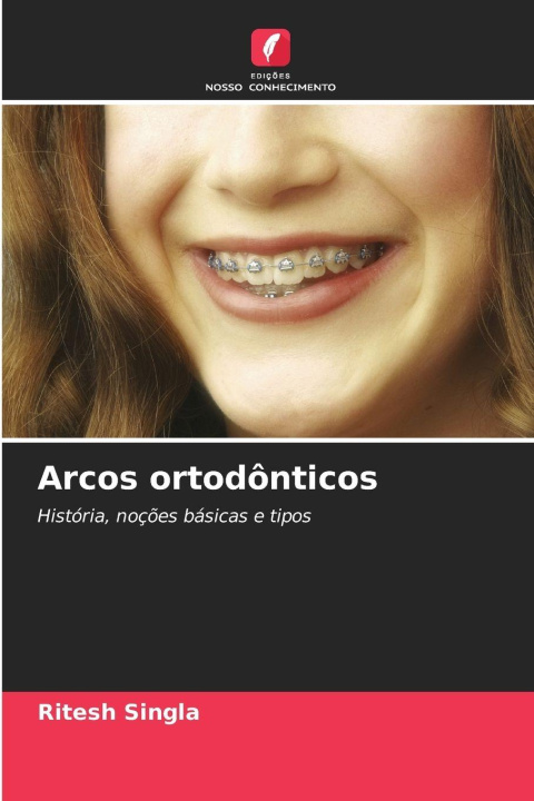 Kniha Arcos ortodônticos Ritesh Singla