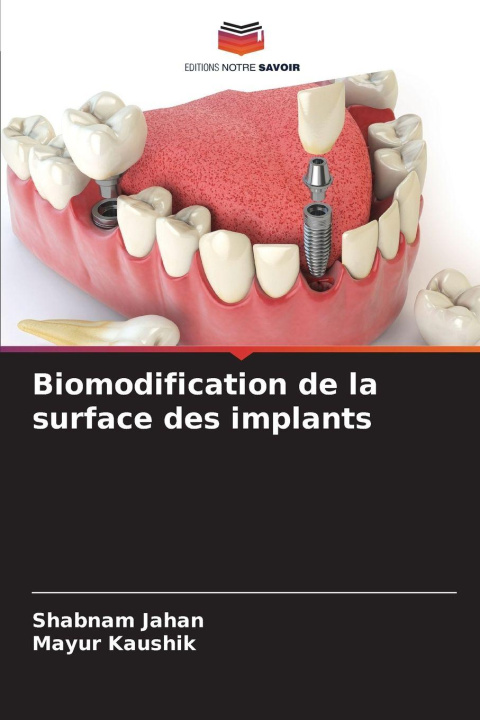 Kniha Biomodification de la surface des implants Mayur Kaushik