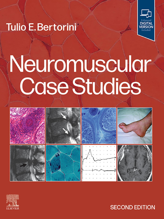 E-book Neuromuscular Case Studies E-Book Tulio E. Bertorini