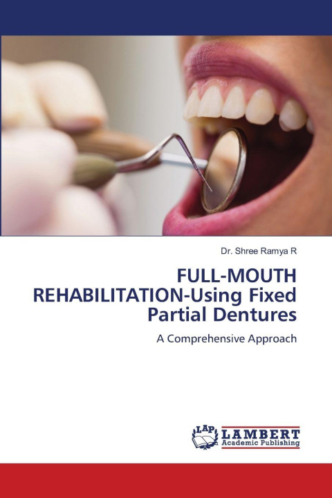 Knjiga FULL-MOUTH REHABILITATION-Using Fixed Partial Dentures Dr. Shree Ramya R
