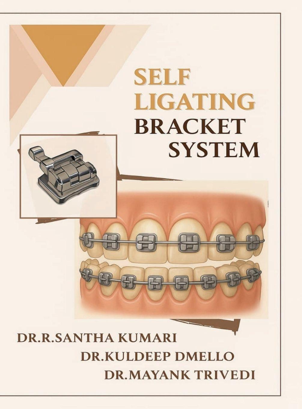 Carte Self Ligating Bracket System Dr. R.SANTHA KUMARI