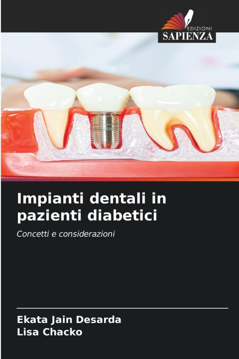 Libro Impianti dentali in pazienti diabetici Ekata Jain Desarda