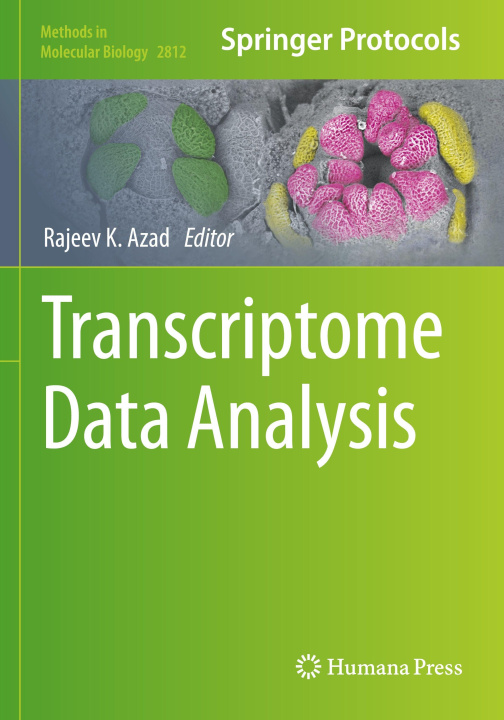 Carte Transcriptome Data Analysis Rajeev K. Azad