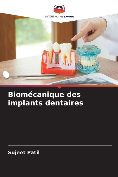 Kniha Biomécanique des implants dentaires Sujeet Patil