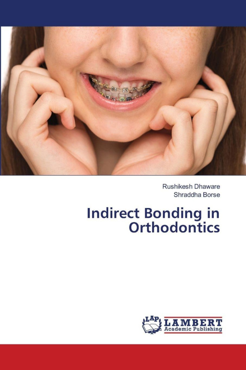 Knjiga Indirect Bonding in Orthodontics Shraddha Borse