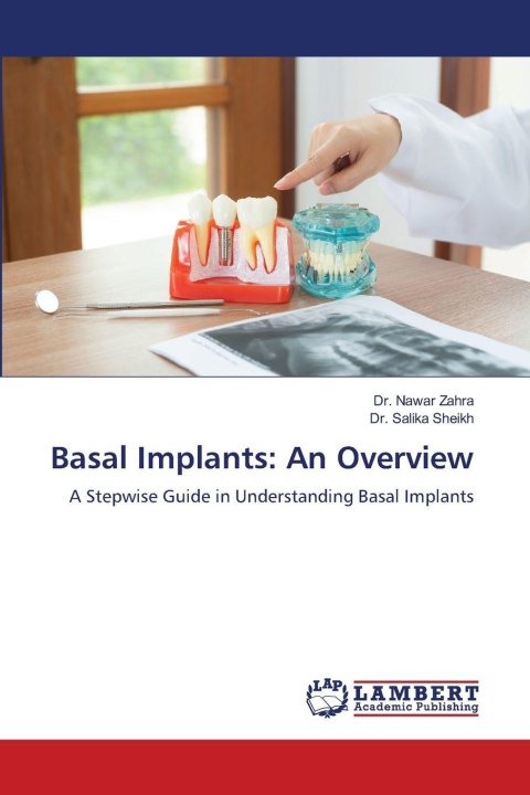 Kniha Basal Implants: An Overview Salika Sheikh