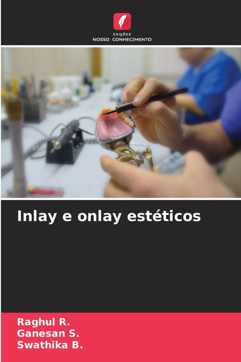 Knjiga Inlay e onlay estéticos Raghul R.