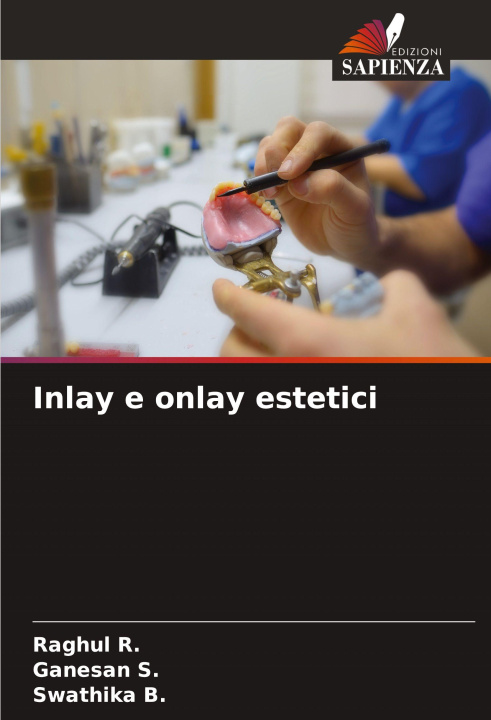 Kniha Inlay e onlay estetici Raghul R.