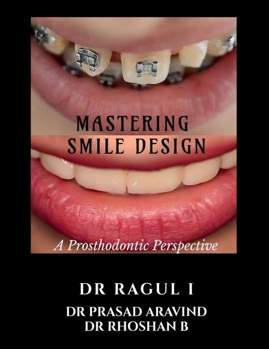 Kniha Mastering Smile Design Dr Ragul I