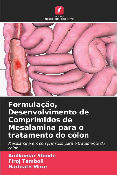 Libro Formulação, Desenvolvimento de Comprimidos de Mesalamina para o tratamento do cólon Firoj Tamboli