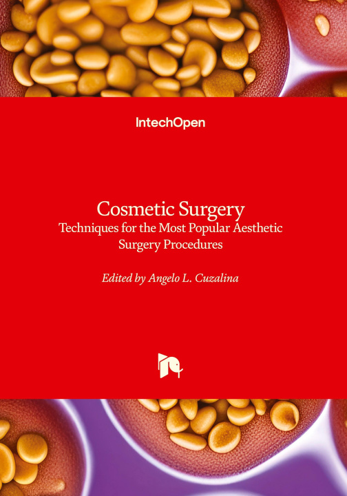 Knjiga Cosmetic Surgery - Techniques for the Most Popular Aesthetic Surgery Procedures Angelo L. Cuzalina