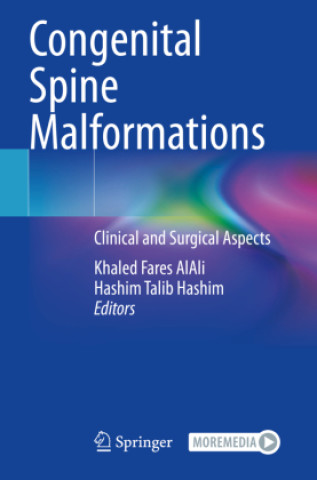 Kniha Congenital Spine Malformations Hashim Talib Hashim