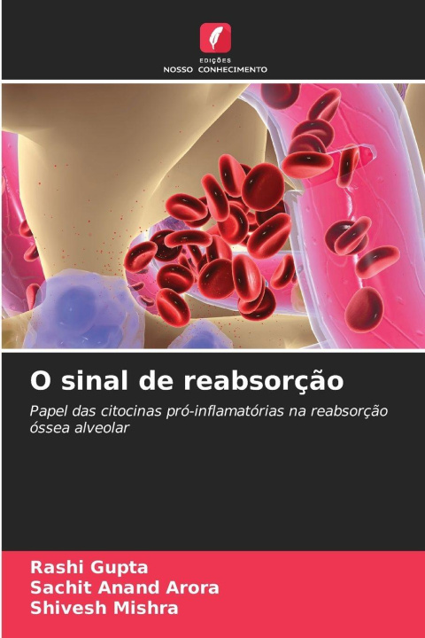 Kniha O sinal de reabsorção Sachit Anand Arora