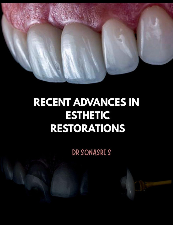 Book Recent Advances in Esthetic Restorations 