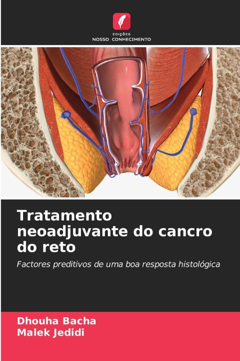 Kniha Tratamento neoadjuvante do cancro do reto Dhouha Bacha
