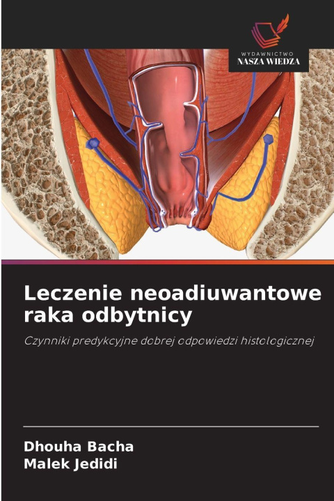 Kniha Leczenie neoadiuwantowe raka odbytnicy Dhouha Bacha