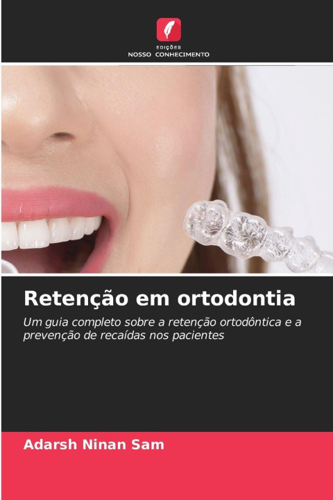 Book Retenção em ortodontia Adarsh Ninan Sam