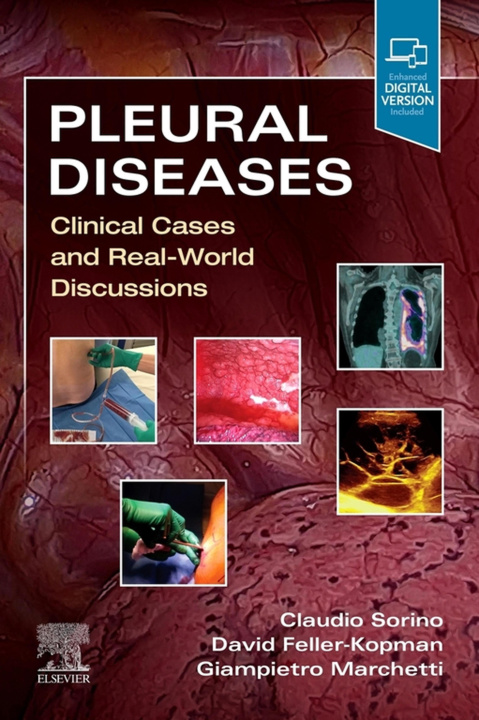 E-kniha Pleural Diseases,E-Book Claudio Sorino