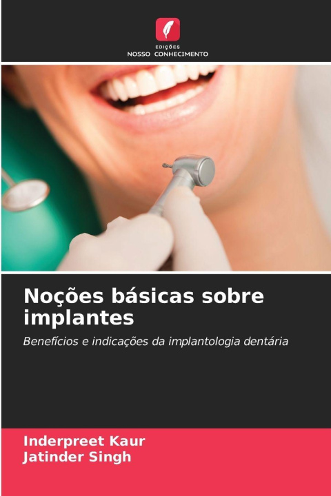 Kniha Noções básicas sobre implantes Jatinder Singh
