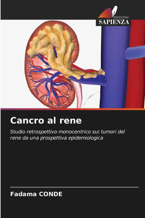 Βιβλίο Cancro al rene Fadama CONDE