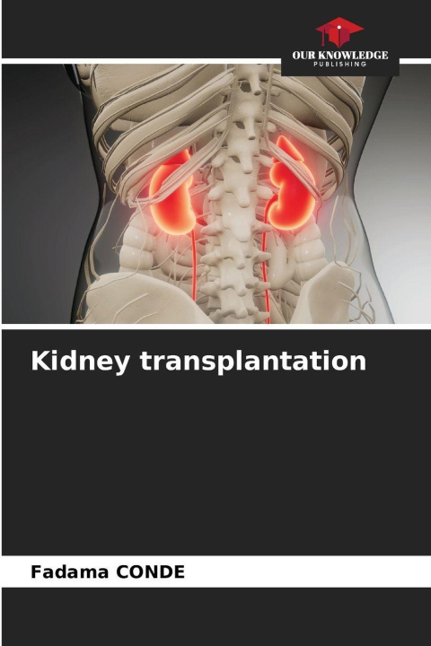 Libro Kidney transplantation Fadama CONDE
