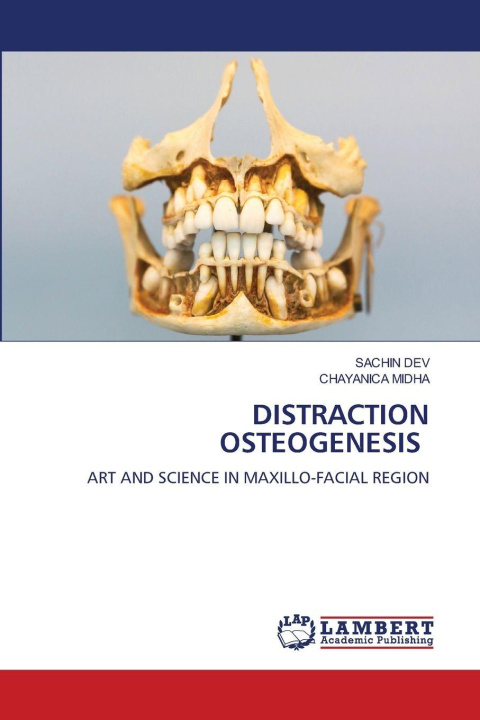 Kniha DISTRACTION OSTEOGENESIS Chayanica Midha