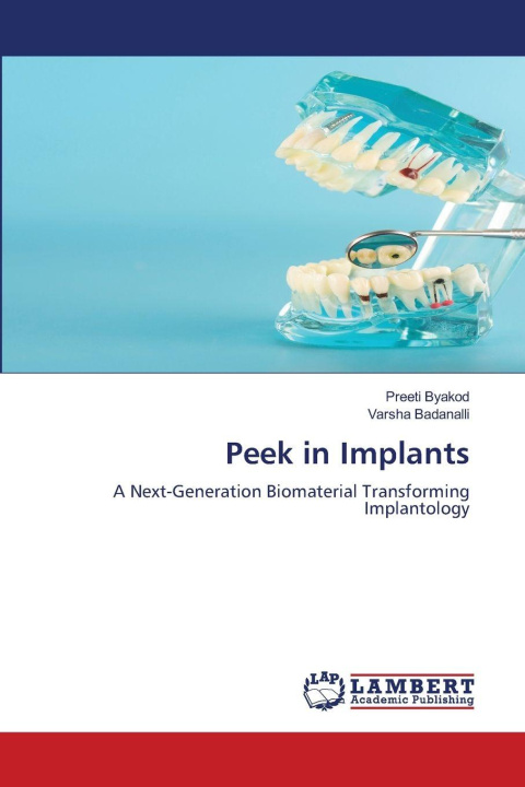 Kniha Peek in Implants Varsha Badanalli