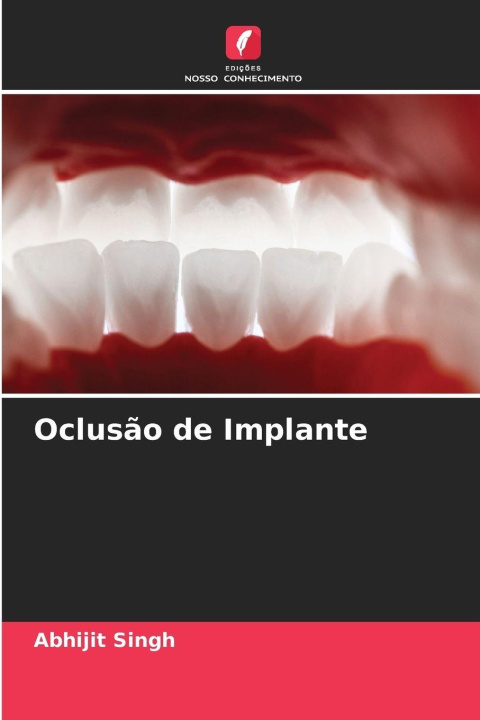 Kniha Oclusão de Implante Abhijit Singh