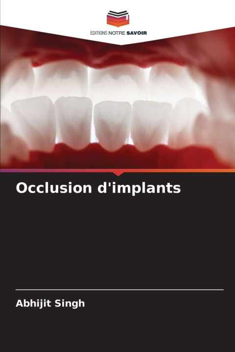 Kniha Occlusion d'implants Abhijit Singh