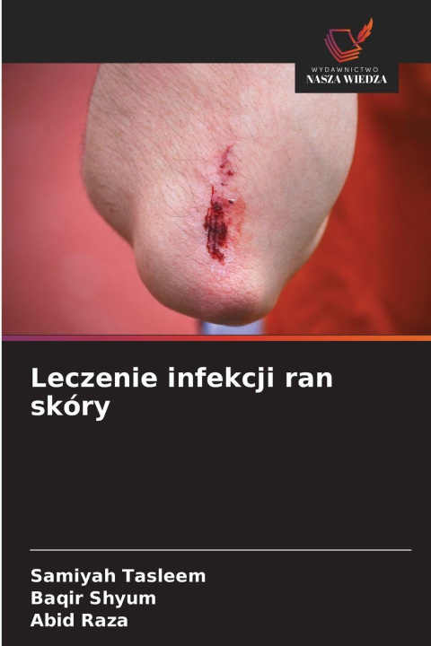 Kniha Leczenie infekcji ran skóry Samiyah Tasleem