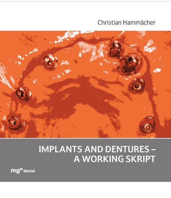 Книга Implants and dentures - a working skript 