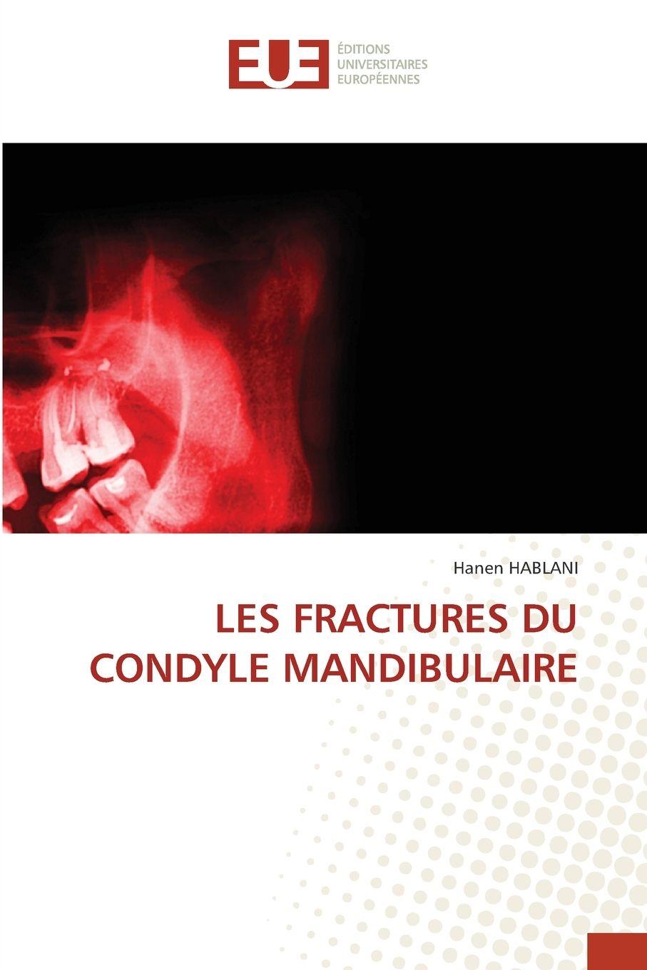 Kniha LES FRACTURES DU CONDYLE MANDIBULAIRE Hanen HABLANI