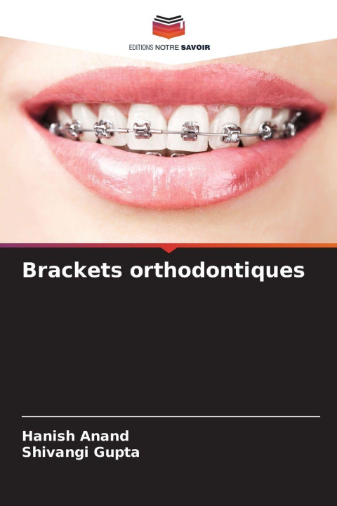 Kniha Brackets orthodontiques Shivangi Gupta