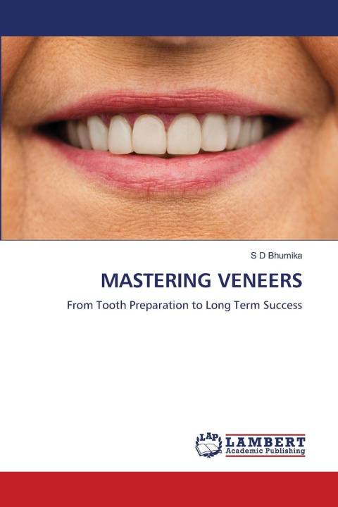 Kniha MASTERING VENEERS S D Bhumika