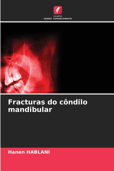 Kniha Fracturas do côndilo mandibular Hanen HABLANI