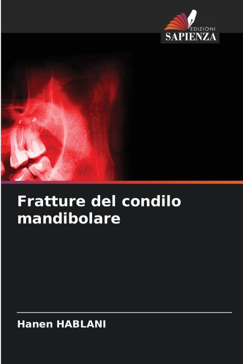 Kniha Fratture del condilo mandibolare Hanen HABLANI