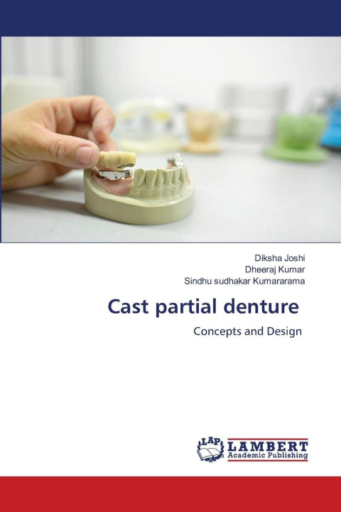Kniha Cast partial denture Diksha Joshi