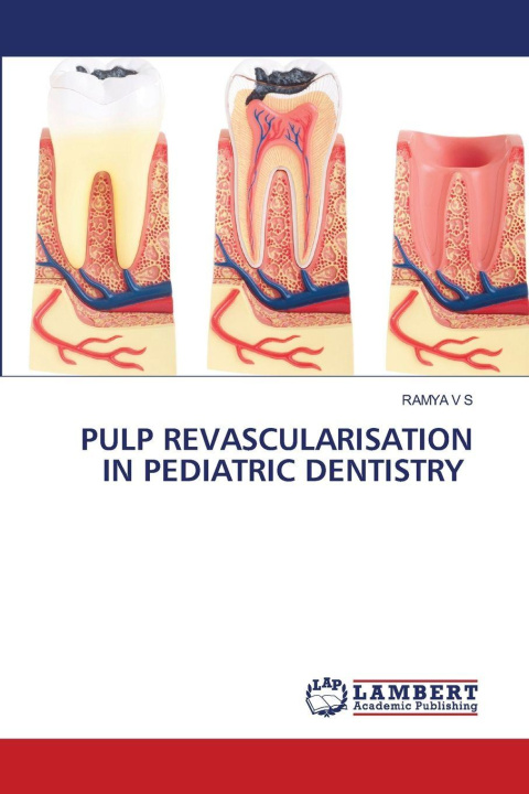 Kniha PULP REVASCULARISATION IN PEDIATRIC DENTISTRY RAMYA V S