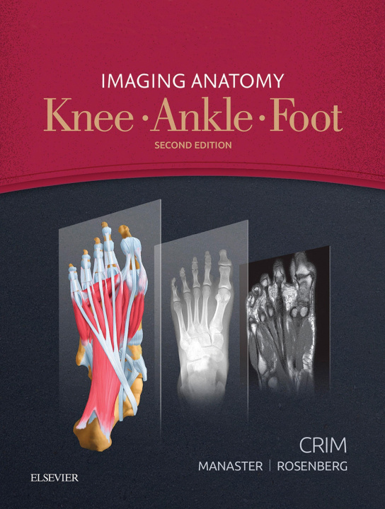 E-knjiga Imaging Anatomy: Knee, Ankle, Foot E-Book Julia R. Crim