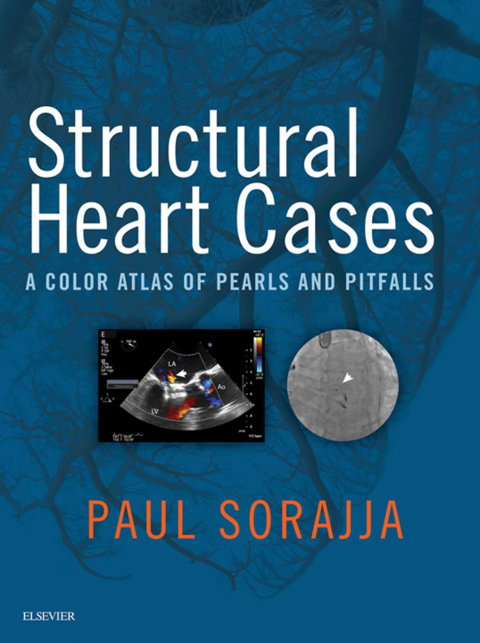 E-book Structural Heart Cases E-Book Paul Sorajja